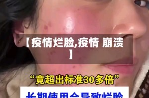 【疫情烂脸,疫情 崩溃】