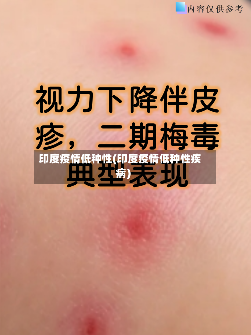 印度疫情低种性(印度疫情低种性疾病)-第1张图片