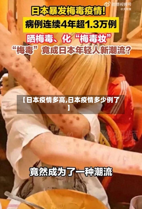 【日本疫情多高,日本疫情多少例了】-第1张图片